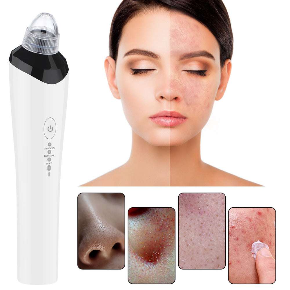 High-Definition Visual Blackhead Meter Three-Speed Intelligent Vacuum Adsorption Pore Cleaner Wifi Timing