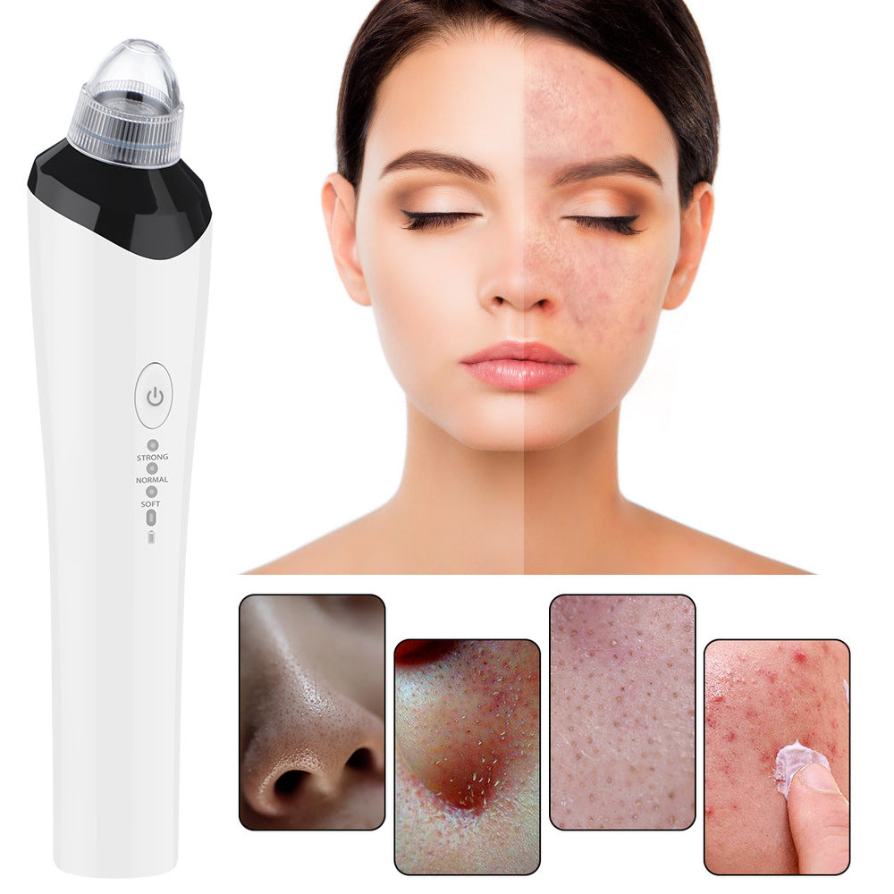 High-Definition Visual Blackhead Meter Three-Speed Intelligent Vacuum Adsorption Pore Cleaner Wifi Timing