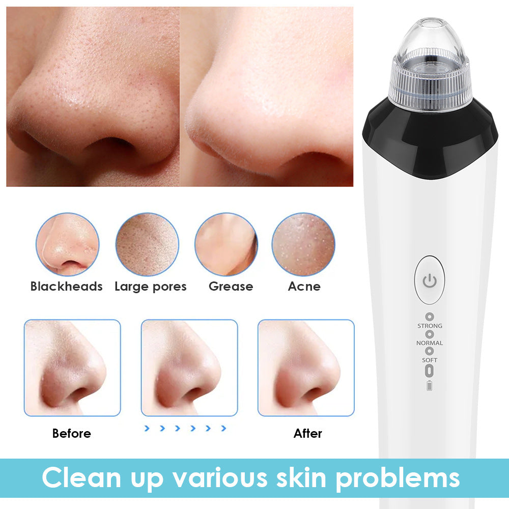 High-Definition Visual Blackhead Meter Three-Speed Intelligent Vacuum Adsorption Pore Cleaner Wifi Timing